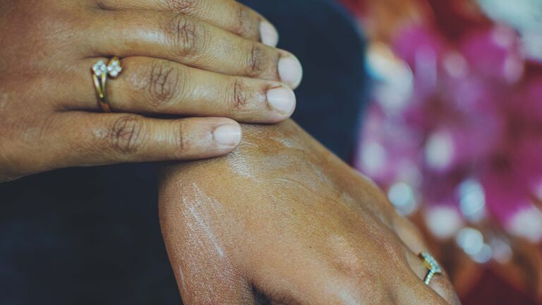 8. Relieve Burns From Cooking