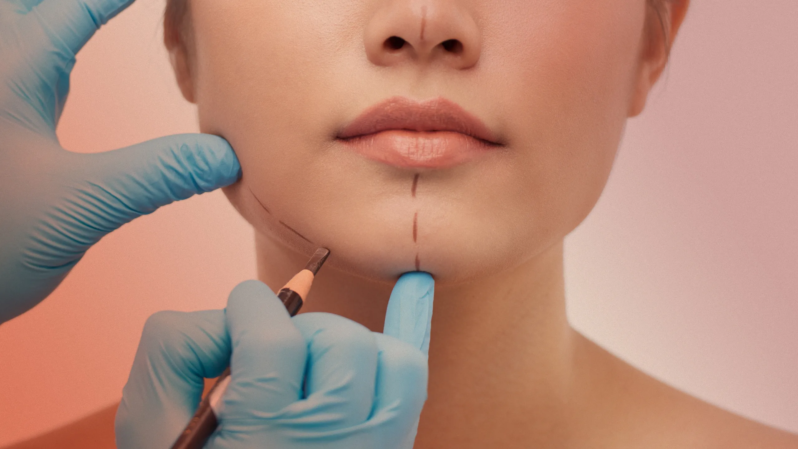 Plastic Surgery Trends